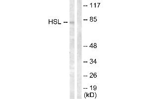 Immunohistochemistry analysis of paraffin-embedded human breast carcinoma tissue using HSL (Ab-554) antibody. (LIPE antibody  (Ser554))