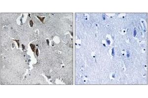 Immunohistochemistry analysis of paraffin-embedded human brain tissue, using ELOVL5 Antibody.