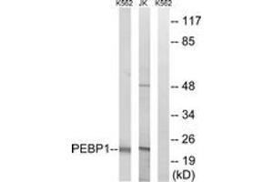 Western blot analysis of extracts from Jurkat/K562 cells, using PEBP1 Antibody.