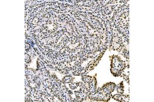 IHC analysis of SSB using anti-SSB antibody (ABIN7602125).