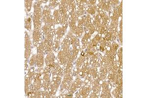 Immunohistochemistry of paraffin-embedded human liver using RC Rabbit pAb (ABIN6129452, ABIN6146811, ABIN6146812 and ABIN6220955) at dilution of 1:150 (40x lens).