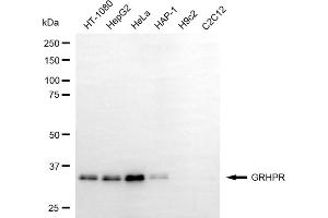 Western blotting analysis using GRHPR antibody (ABIN7798786).