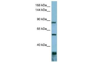 EPS8 antibody used at 1 ug/ml to detect target protein. (EPS8 antibody  (Middle Region))