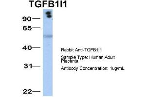 Western Blotting (WB) image for anti-Transforming Growth Factor beta 1 Induced Transcript 1 (TGFB1I1) (Middle Region) antibody (ABIN2777947)