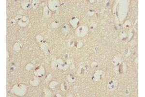 Immunohistochemistry of paraffin-embedded human brain tissue using ABIN7163172 at dilution of 1:100 (PIK3R3 antibody  (Regulatory Subunit Gamma))