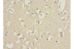 Immunohistochemistry of paraffin-embedded human brain tissue using ABIN7163172 at dilution of 1:100 (PIK3R3 antibody  (Regulatory Subunit Gamma))