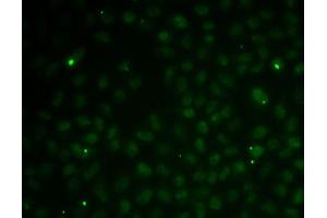 Immunofluorescence analysis of MCF7 cells using RC antibody (ABIN6132580, ABIN6146644, ABIN6146647 and ABIN6216132). (RAD51C antibody  (AA 1-135))