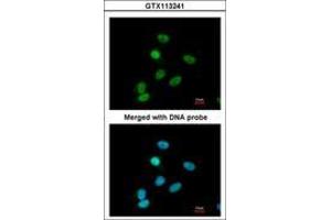 Image no. 2 for anti-Paired Box 6 (PAX6) (AA 1-221) antibody (ABIN467590) (PAX6 antibody  (AA 1-221))