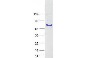 Western Blotting (WB) image for Growth Associated Protein 43 (GAP43) (Transcript Variant 2) protein (Myc-DYKDDDDK Tag) (ABIN2721683)