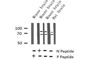 Western blot analysis of Phospho-Lamin A/C (Ser392) expression in various lysates