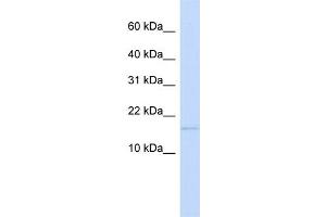 WB Suggested Anti-C3orf18 Antibody Titration:  0. (C3orf18 antibody  (N-Term))