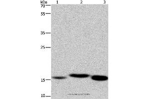 Western blot analysis of Mouse kidney, human fetal liver and mouse liver tissue, using CYB5A Polyclonal Antibody at dilution of 1:250 (Cytochrome b5 (CYTB5) antibody)