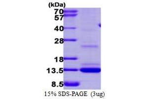 SDS-PAGE (SDS) image for Matrix Gla Protein (MGP) (AA 20-96) protein (His tag) (ABIN667546) (MGP Protein (AA 20-96) (His tag))