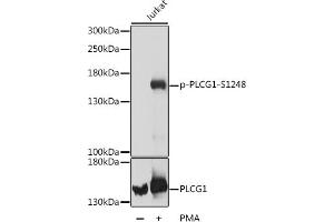 Western blot analysis of extracts of Jurkat cells, using Phospho-PLC gamma 1 (PLCG1)-S1248 antibody (ABIN7269347) at dilution or PLC gamma 1 (PLCG1) antibody . (Phospholipase C gamma 1 antibody  (pSer1248))