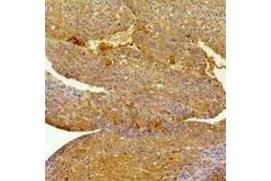 Immunohistochemistry (IHC) image for anti-Ephrin Type A Receptor 1 (EPHA1) antibody (ABIN7305380)