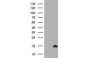 Image no. 1 for anti-Cystatin SA (CST2) antibody (ABIN1497760)