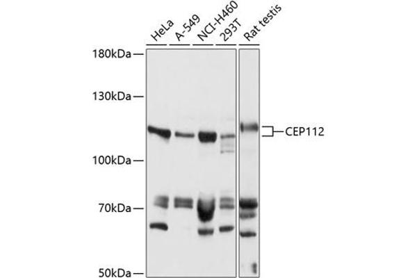 CCDC46 anticorps  (AA 1-240)