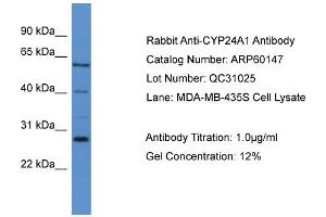 WB Suggested Anti-CYP24A1  Antibody Titration: 0.