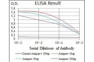 Black line: Control Antigen (100 ng), Purple line: Antigen(10 ng), Blue line: Antigen (50 ng), Red line: Antigen (100 ng), (ALPL antibody)