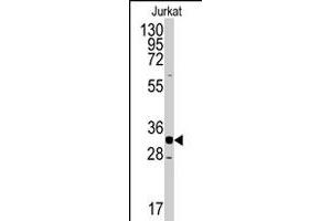 Western blot analysis of CDK2 polyclonal antibody  in Jurkat cell line lysates (35 ug/lane).