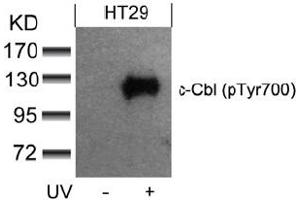 Image no. 3 for anti-Cas-Br-M (Murine) Ecotropic Retroviral Transforming Sequence (CBL) (pTyr700) antibody (ABIN319294) (CBL antibody  (pTyr700))