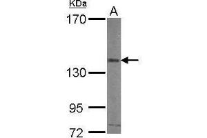 WB Image Sample (30 ug of whole cell lysate) A: HUVEC 7. (CD51 antibody  (C-Term))