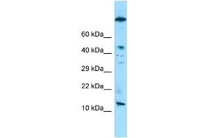 WB Suggested Anti-VCY Antibody Titration: 1. (Variable Charge, Y-Linked (VCY) (N-Term) antibody)