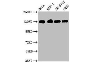 Western Blot Positive WB detected in: Hela whole cell lysate, MCF-7 whole cell lysate, SH-SY5Y whole cell lysate, U251 whole cell lysate All lanes: Integrin beta-1/CD29 antibody at 1. (Recombinant ITGB1 antibody)