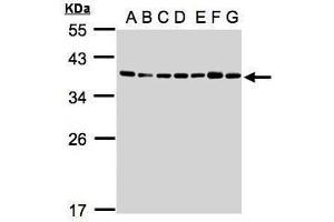 WB Image Sample(30μg whole cell lysate) A: 293T B: A431 , C: H1299 D: HeLa S3 , E: Hep G2 , F: MOLT4 , G: Raji , 12% SDS PAGE antibody diluted at 1:1000 (U2AF1 antibody)