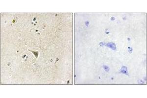 Immunohistochemistry analysis of paraffin-embedded human brain tissue, using LRRK1 Antibody. (LRRK1 antibody  (AA 361-410))