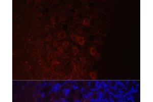 Immunofluorescence analysis of Rat brain using NEFH Polyclonal Antibody at dilution of 1:100. (NEFH antibody)