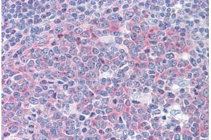 Human Tonsil: Formalin-Fixed, Paraffin-Embedded (FFPE) (FARSB antibody  (AA 234-342))