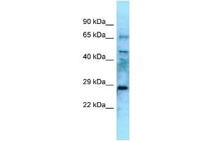 WB Suggested Anti-Eya4 Antibody Titration: 1. (EYA4 antibody  (N-Term))