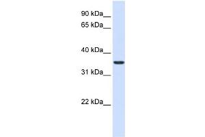 WB Suggested Anti-TXNDC14 Antibody Titration:  0.