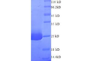 SDS-PAGE (SDS) image for N-Ethylmaleimide-Sensitive Factor (NSF) (AA 7-209), (partial) protein (His tag) (ABIN4977009)