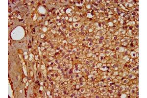 IHC image of ABIN7155179 diluted at 1:600 and staining in paraffin-embedded human adrenal gland tissue performed on a Leica BondTM system. (PDE9A antibody  (AA 426-533))