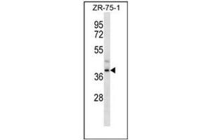 Western blot analysis of FPR3 Antibody (C-term) in ZR-75-1 cell line lysates (35ug/lane).