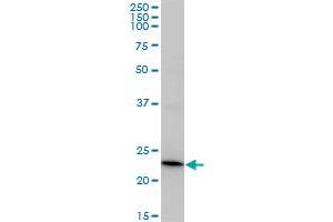 RCV1 monoclonal antibody (M37), clone 3F6. (Recoverin antibody  (AA 1-200))