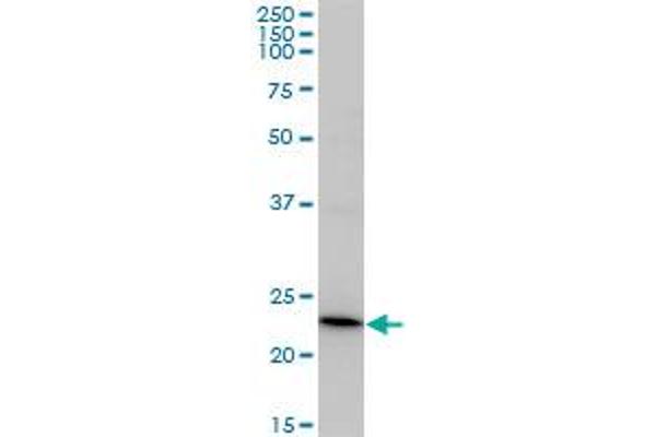 Recoverin antibody  (AA 1-200)