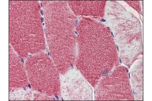Human Skeletal Muscle: Formalin-Fixed, Paraffin-Embedded (FFPE) (POLG antibody  (AA 829-1201))