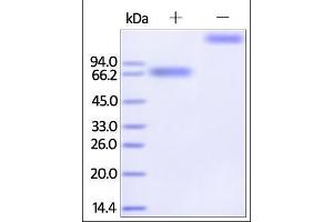 SDS-PAGE (SDS) image for Interleukin 21 Receptor (IL21R) (AA 20-236) (Active) protein (Fc Tag) (ABIN2181374)
