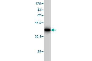 Western Blot detection against Immunogen (32. (SLC11A2 antibody  (AA 1-65))