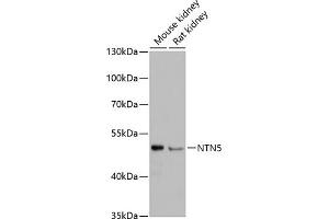 Western blot analysis of extracts of various cell lines, using NTN5 antibody (ABIN6132148, ABIN6144903, ABIN6144904 and ABIN6217109) at 1:3000 dilution. (Netrin 5 antibody  (AA 340-489))