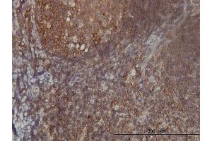 Immunostaining (ISt) image for anti-Phenylalanyl-tRNA Synthetase, beta Subunit (FARSB) (AA 234-341) antibody (ABIN564345)