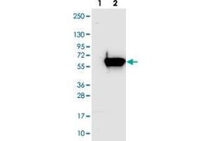 Western blot analysis of Lane 1: Negative control (vector only transfected HEK293T lysate). (AGXT2L1 antibody)