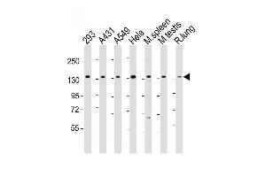 Western Blotting (WB) image for anti-Splicing Factor 3b, Subunit 2, 145kDa (SF3B2) (AA 539-568) antibody (ABIN5532107)
