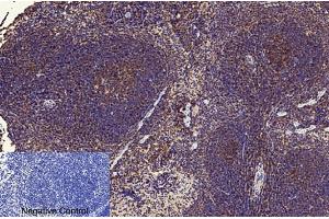 Immunohistochemical analysis of paraffin-embedded mouse spleen tissue. (NF-kB p65 antibody  (acLys310))