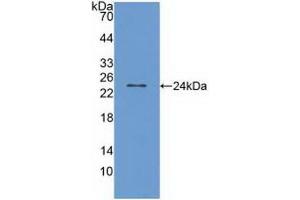 Detection of Recombinant TRPV1, Human using Polyclonal Antibody to Transient Receptor Potential Cation Channel Subfamily V, Member 1 (TRPV1) (TRPV1 antibody  (AA 1-153))