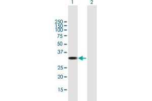 Western Blot analysis of UCP2 expression in transfected 293T cell line by UCP2 MaxPab polyclonal antibody. (UCP2 antibody  (AA 1-309))