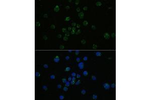 Immunofluorescence analysis of Jurkat cells using CD4 antibody (ABIN6132069, ABIN6138186, ABIN6138188 and ABIN6213820) at dilution of 1:100. (CD4 antibody  (AA 26-200))